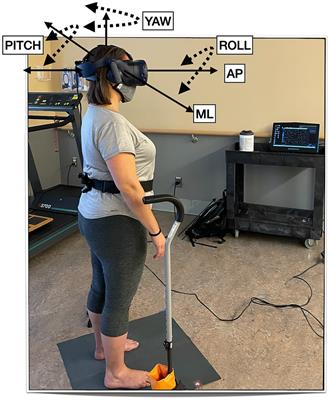 Can head sway patterns differentiate between patients with Meniere’s disease vs. peripheral vestibular hypofunction?